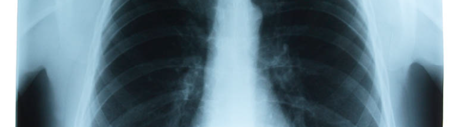 EVERYTHING COOL NOVEMBER IS LUNG CANCER AWARENESS MONTH