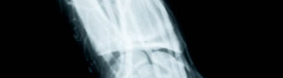 EVERYTHING COOL NOV 8 X-RAY DAY
